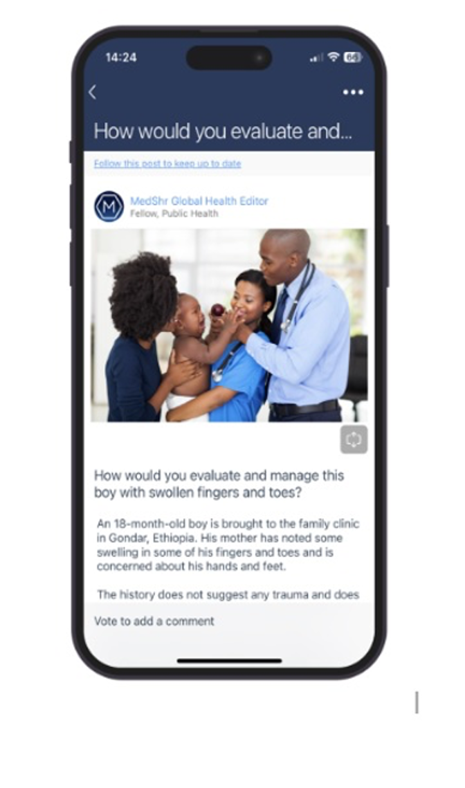 Sickle Cell Case example